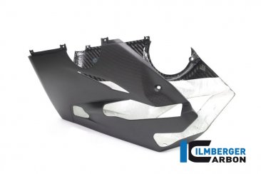 Carbon Fiber Bellypan by Ilmberger Carbon